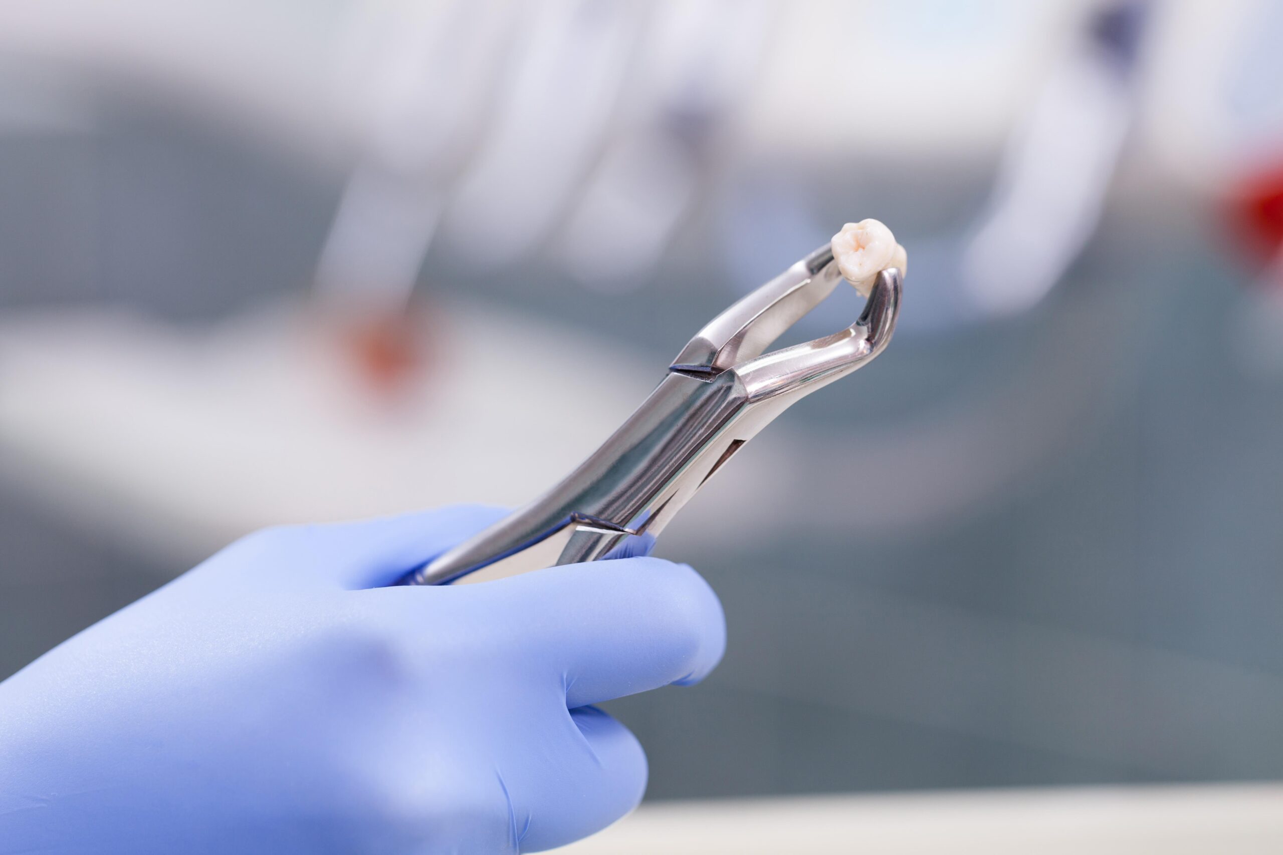 Dental Forceps Set For Extraction Of Tooth